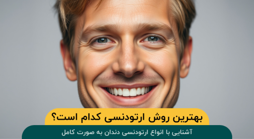 بهترین نوع ارتودنسی دندان